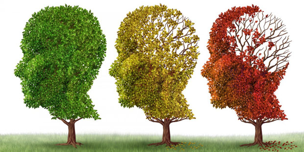 ﻿El Alzheimer no es contagioso
